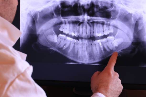 Best Emergency Root Canal Treatment in Richmond West, FL